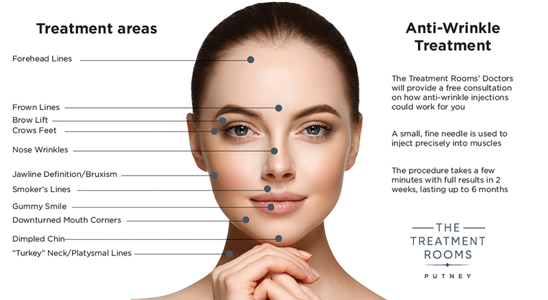 Botox London