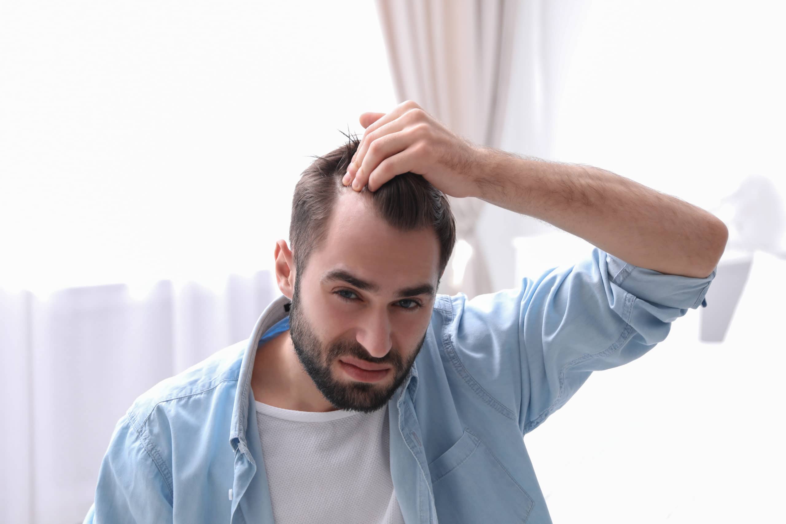 Man with hair loss looking in mirror