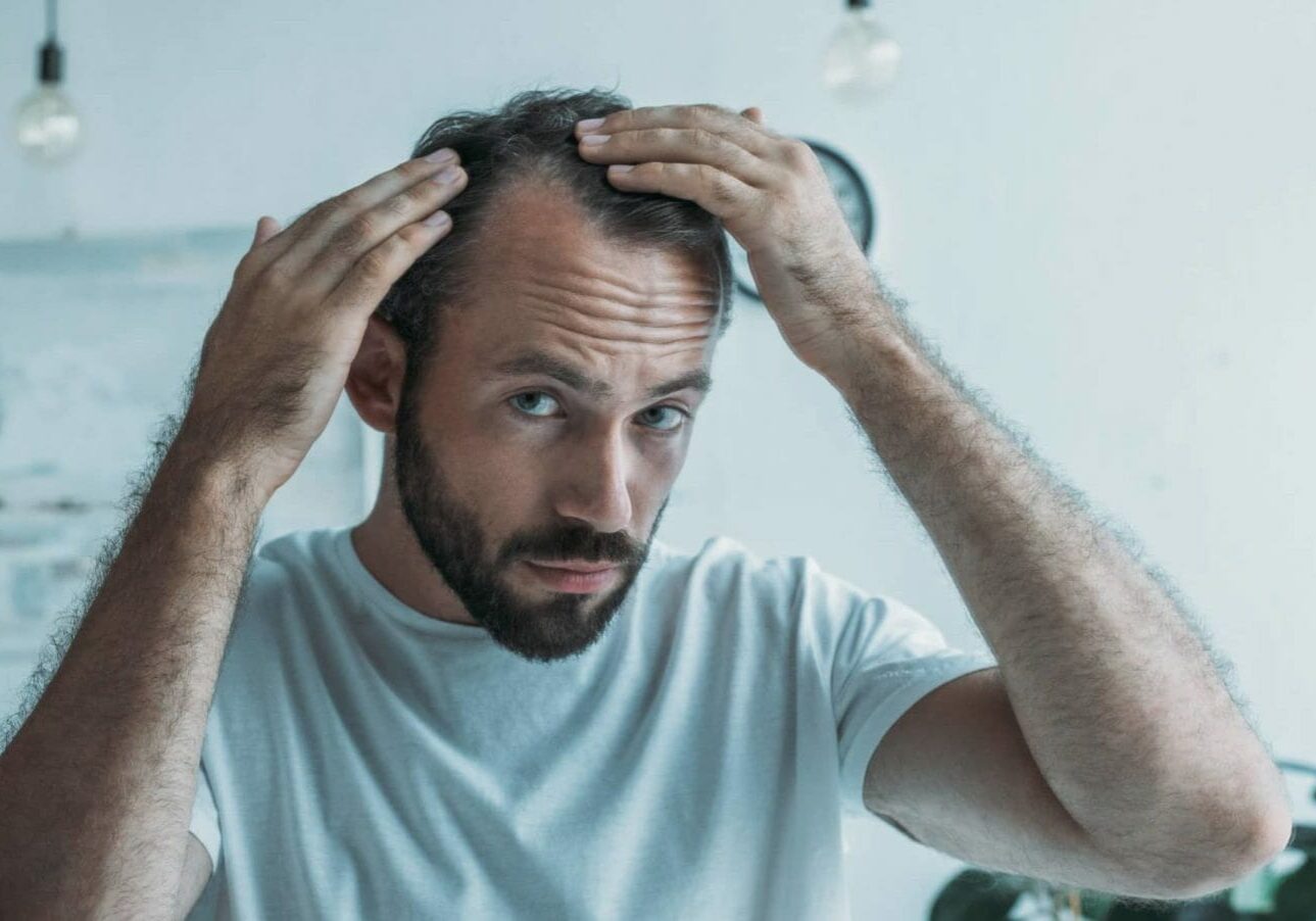illnesses that causes hair loss