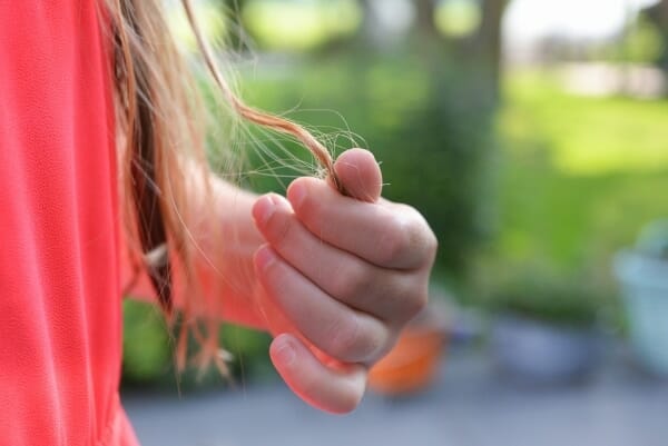 female hair loss