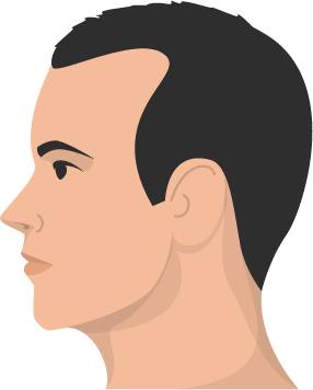 A Guide To Female Hair Loss - The Treatment Rooms London A Guide To Female Hair Loss - The Treatment Rooms London